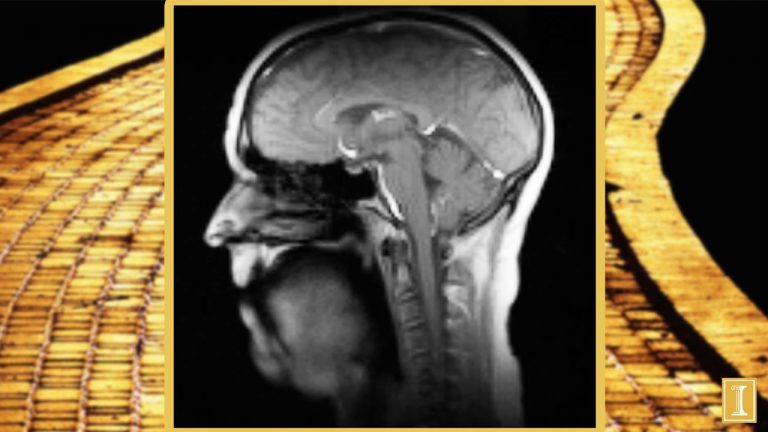 What Happens When You Sing During An MRI