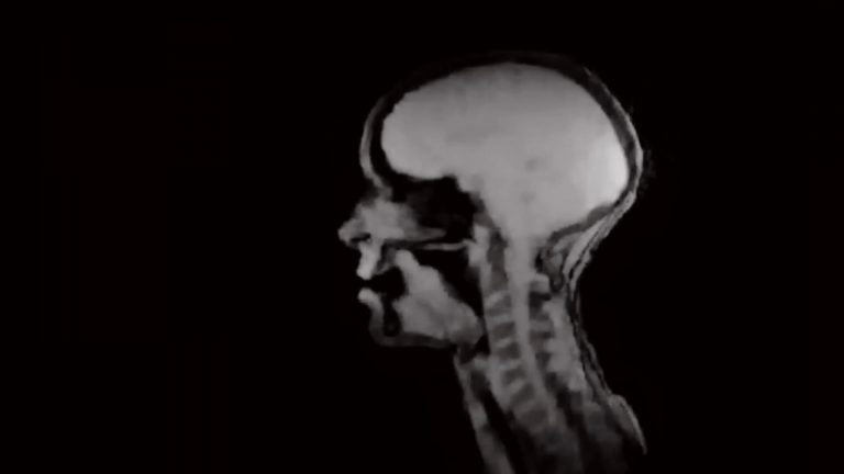 What Happens When You Sing During An MRI? This!